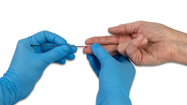 Step 2 Transfer tube getting blood sample. Conducting a PT/INR test with the Assure PT Care Meter​. ARKRAY USA, Inc.